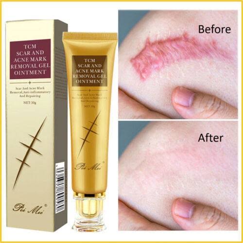 PEI MEI-SCAR AND ACNE MARK REMOVAL GEL